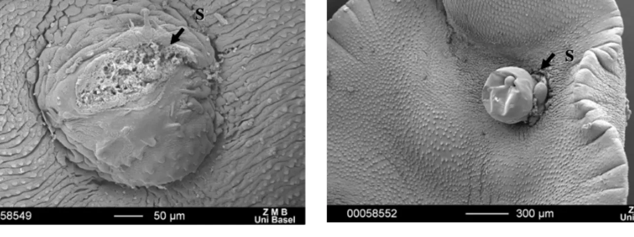 Figure 3. SEM observation of adult F. hepatica recovered from rat bile ducts 3 days after the administration of OZ78 at a dose of 100 mg/kg