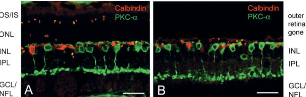 Fig. 6. Double labeling for calbindin D-28 ~horizontal cells, in red! and protein kinase C-a ~rod bipolar cells, in green! in retina #13, 30 days after IAA administration