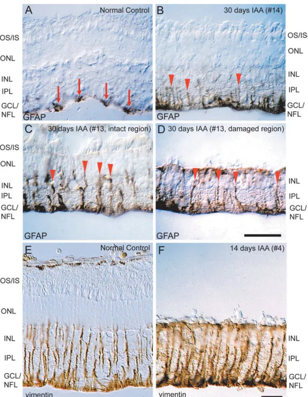 Fig. 7. The effect of IAA on glial cell immunoreactivity. Fig. 7A shows immunoreactivity for glial fibrillary acidic protein ~GFAP! in a control retina ~#1! and Fig