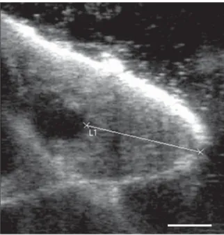 Fig. 3. Formalin-fixed buffalo teat with the true teat canal (1) and the collapsed distal part of the cistern (2).