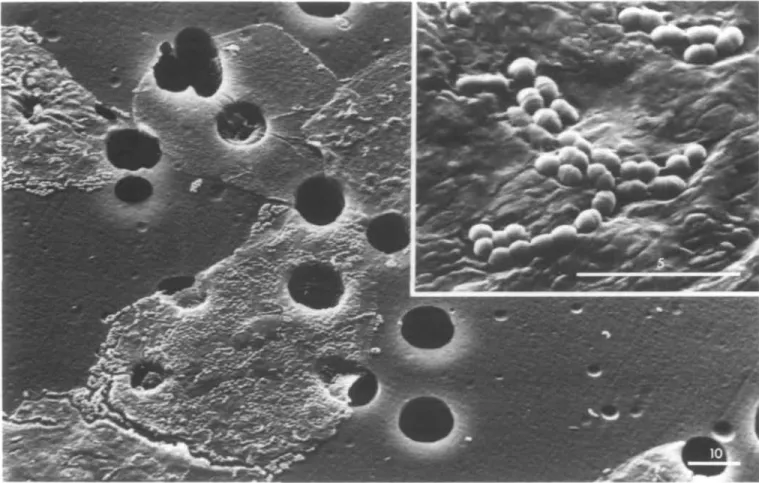 Fig. 1. Scanning electron micrographs of S.sanguis OMZ 9 binding to HBEC held by polycarbonate filters