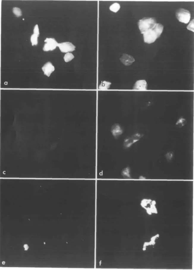 Fig. 5. Fluorescence micrographs of exfoliated HBEC (a-d) and cultured SqCC/Yl cells (e, f)