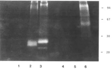 Fig. 6. SDS-PAGE analysis of total cell extracts from exfoliated HBEC (lanes 1-3) and cultured SqCC/Yl cells (lanes 4-6)