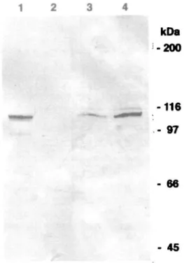 Table L Glucosidase II activity in cell lysate