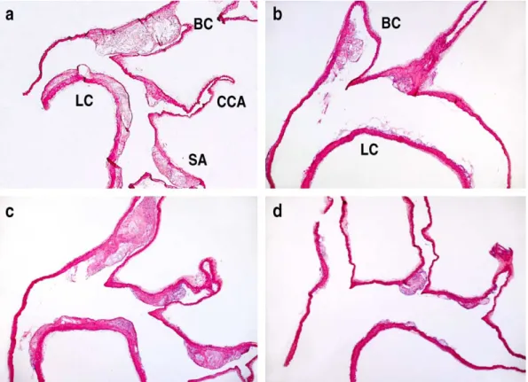 Fig. 4. The presence of IL-1Ra mRNA isoforms in aortic roots with and without atherosclerotic lesions
