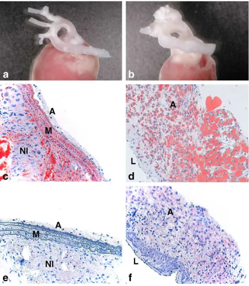 Fig. 5. Macroscopic and histological examination of hearts and aortic arches. ApoE / IL-1Ra +/+ (a, c, e) and ApoE / IL-1Ra / (b, d, f) mice were fed with cholesterol-rich diet for 7 weeks