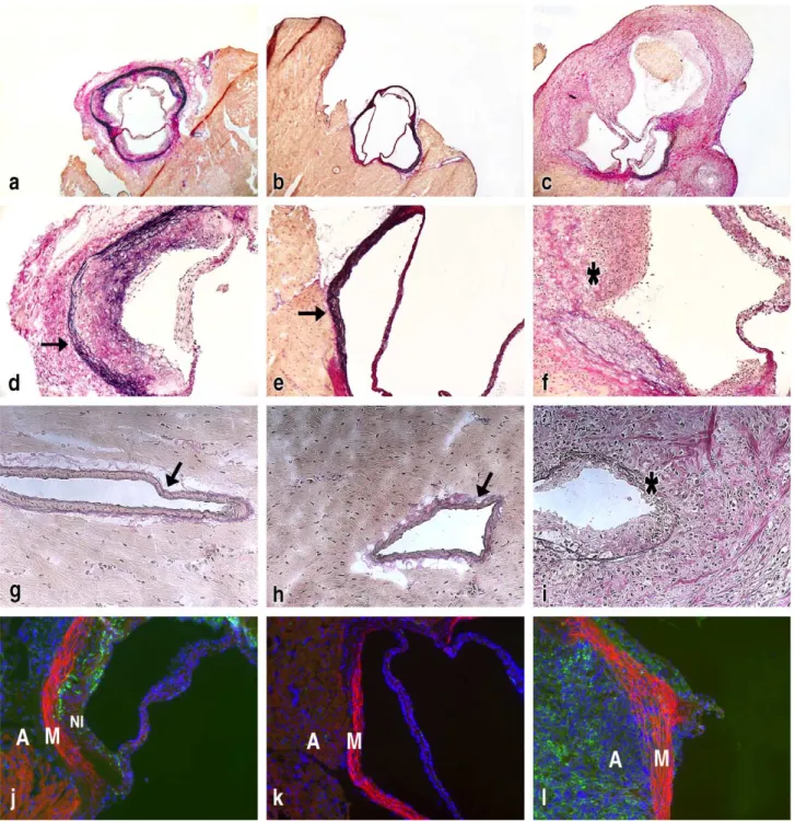 Fig. 6. Histological examination of inflammation in aortic roots and coronary arteries