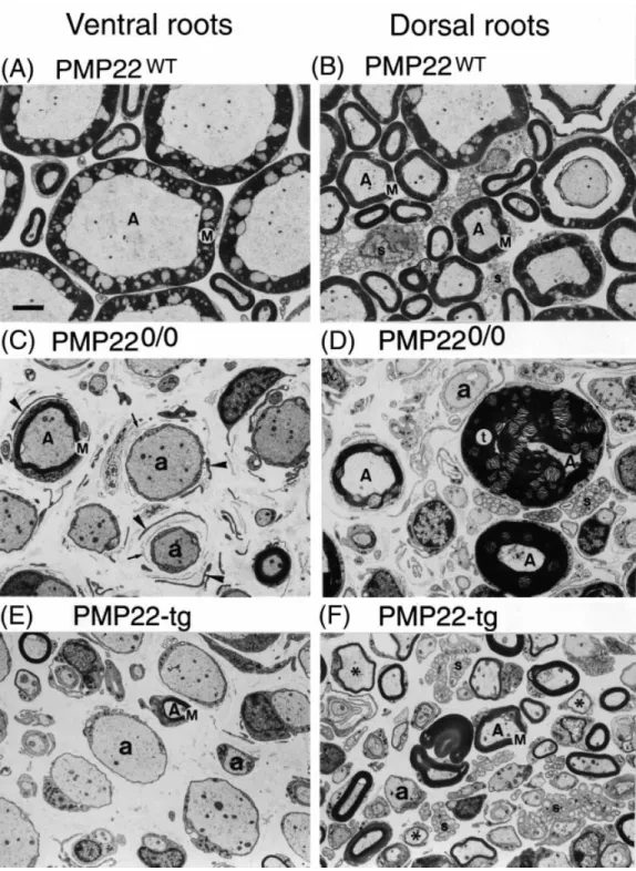 Fig. 6 Electron micrographs comparing the ultrastructure of the L3 ventral roots (A, C, E) and L3 dorsal roots (B, D and F) of wild-type (A and B), PMP22 0/0 (C and D) and PMP22-transgenic (E and F) mice