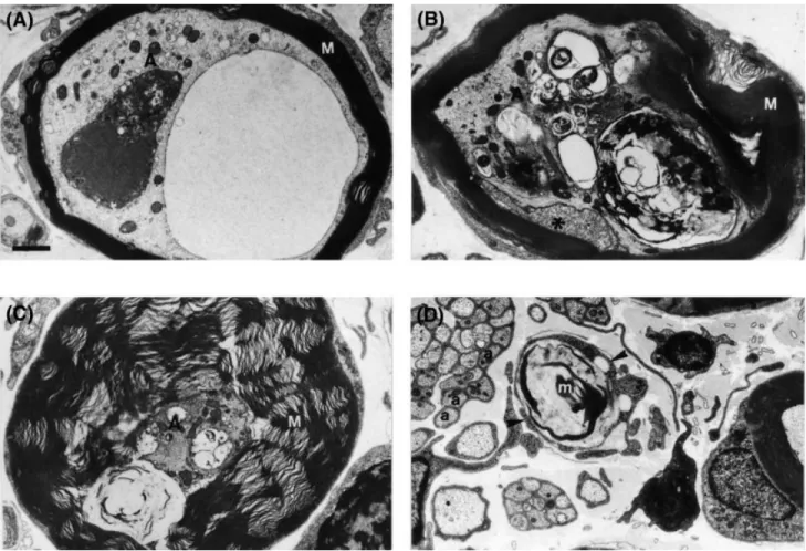 Fig. 7 Ultrastructure of selected abnormal axons in the nerves of PMP22 0/0 mice. Transverse sections from the L3 ventral root (A) and saphenous nerve (B–D)