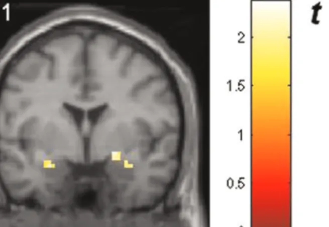 Fig. 4 Response of the amygdalae to masked happy faces compared with masked neutral faces (ROI analysis): left amygdala [peak voxel xyz, 27, 1, 20 (MNI coordinates), cluster size: 8, Z-score ¼ 2.03] and right amygdala (peak voxel xyz, 21, 2, 14, cluster si