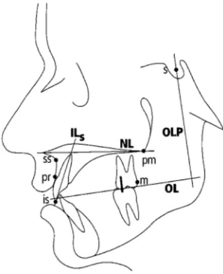Figure 3 Reference points and lines used in the measure- measure-ments on the cephalograms.