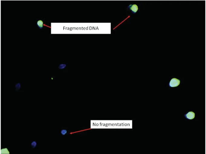 Figure 3 In situ determination of sperm DNA fragmentation with TUNEL. Pale green: fragmented DNA; blue: DNA presenting no fragmentation.