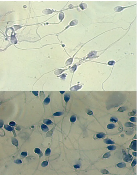 Figure 4 In situ determination of sperm decondensation index (SDI) using aniline blue