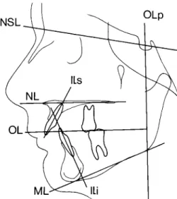 Figure 3 Reference lines used in the cephalometric analysis.