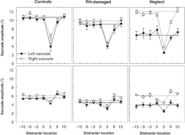 Figure 5 illustrates that in contrast to the control groups, neglect patients showed a massive latency increase of saccades in both directions when a distracter appeared at fixation