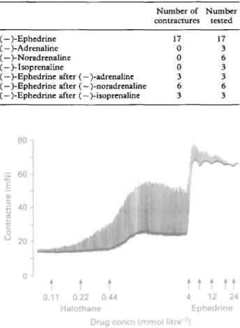 TABLE I. In vitro contractures  ( ^ 2 mN) initiated by various adrenoceptor agonists in 29 muscle bundles from MHS subjects