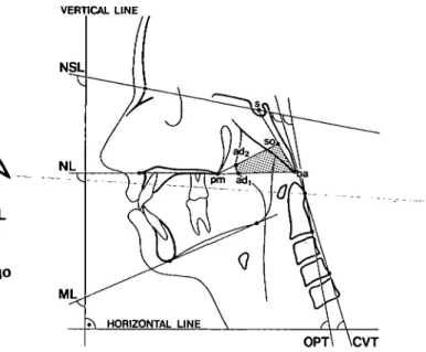 Figure 2 Reference points and lines used in the analysis of facial morphology.