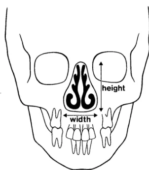 Figure 4 Measurements of width and height of the nasal cavity and size of the nasal air passage on the frontal cephalogram.