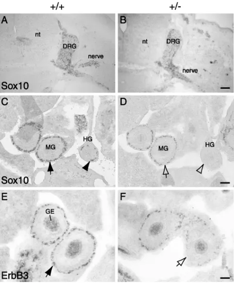 Figure 2. The hindgut of Sox10 lacZ/þ mutants is not colonized by enteric progenitor cells and the number of progenitors in more proximal parts of the gut is reduced