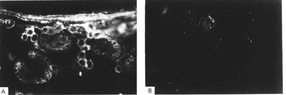 Fig. 1. Immunofluorescence analyses of cryosections from Echinococcus multilocularis metacestode tissue (liver lesion from a naturally infected rodent, see Materials and Methods section) using (A) rabbit hyperimmune serum against recombinant II/3-10 antige