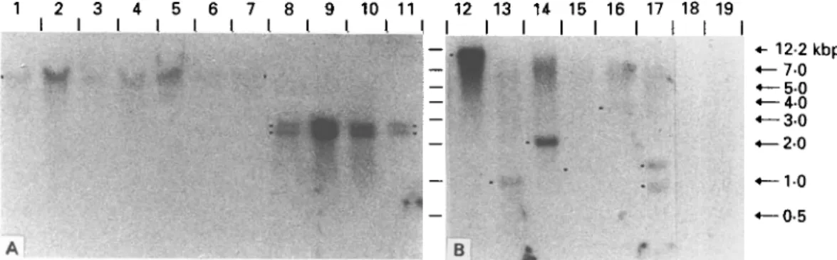 Fig. 5. Southern analyses of genomic DNA with radioactively labelled insert of clone II/3 as a probe