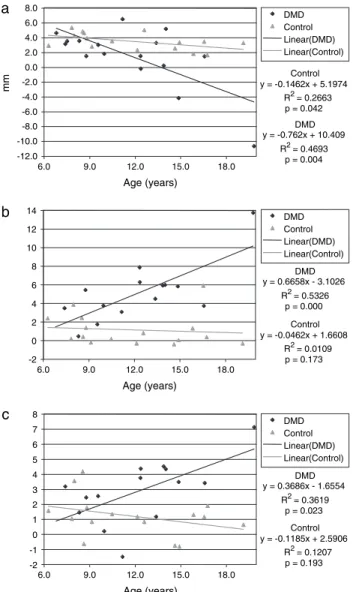 Figure 5        Overjet (a) and arch widths at the lower (b) and upper (c) fi  rst  molar in the Duchenne muscular dystrophy (DMD) patients and control  group and their linear regression lines