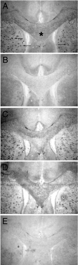 Figure 4 shows cross-sections of adult rat brain which were stained with different recombinant F ab fragments, followed by a secondary antibody conjugated with a reporter enzyme.