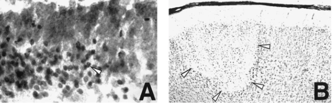 Figure 1. Pattern of neuronal in- in-jury in infant rats with group B  strep-tococcal meningitis
