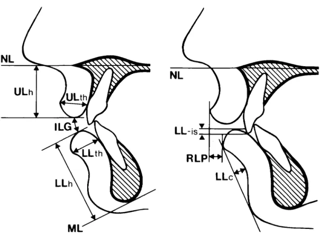 Figure 4 (a and b) Measurements of lip morphology and position on profile cephalogram.