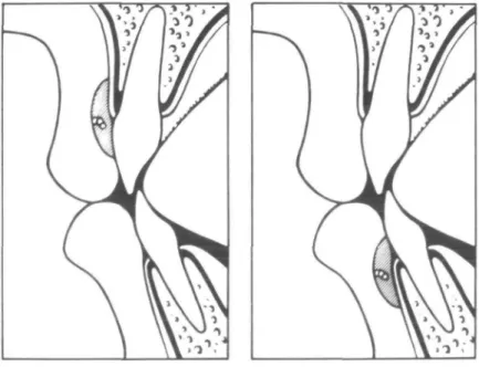 Figure 7 Schematic view of the measuring point for lip pressure on the upper and lower incisors.