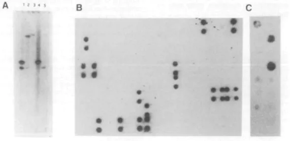 Figure 2. Localization of exons to chromosome 21. (A) Genomic Southern blot hybridized with exon 4E2