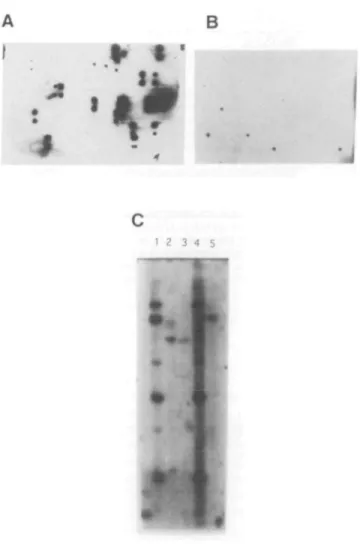 Figure 5. Northern blot analysis with the cDNA clone containing exon 3E2.