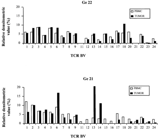 Fig. 1. Relative TCR BV gene segment expression in astrocytoma and PBMC samples from patients Ge22 and Ge21