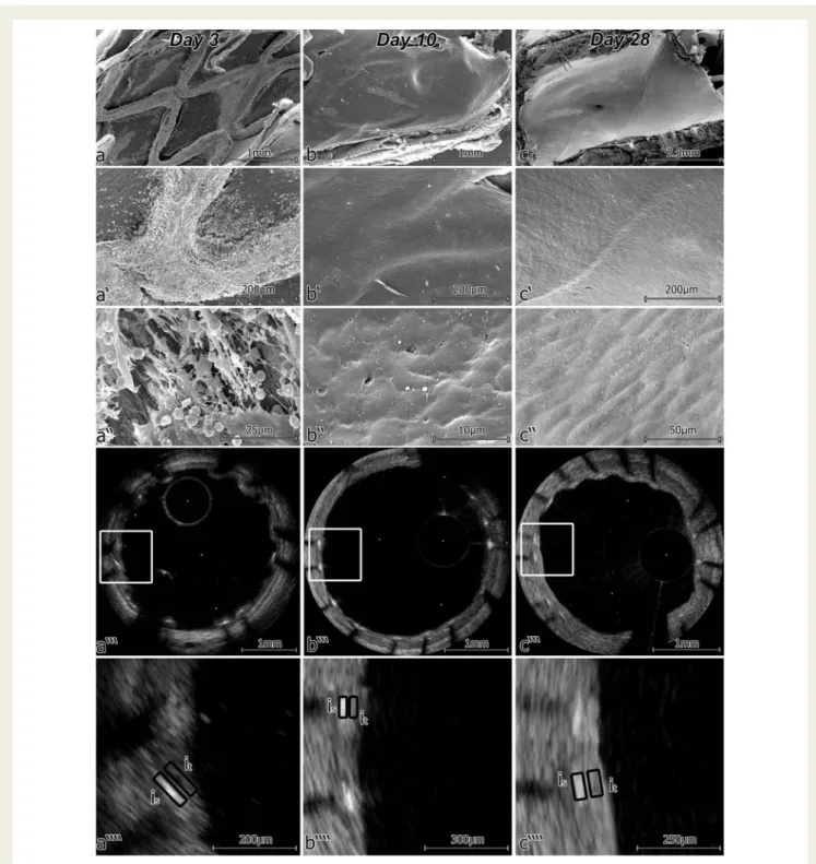 Figure 2 Different characteristics of stent strut coverage at different time points after stent implantation, i.e