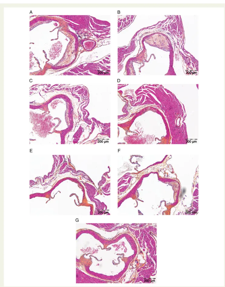 Figure 2 Effect of anacetrapib, atorvastatin, and their combination on plaque morphology