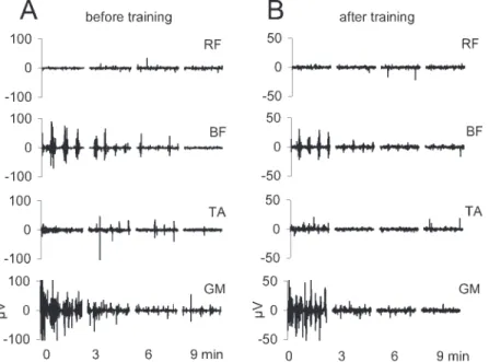 Table 2 Effect of training on exhaustion of EMG Subject EMG activity after 10 min walking
