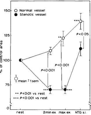 Figure 2 Responses of normal and stenotic coronary arteries to dynamic exercise in patients with coronary artery disease and exercise-induced angina pectoris.