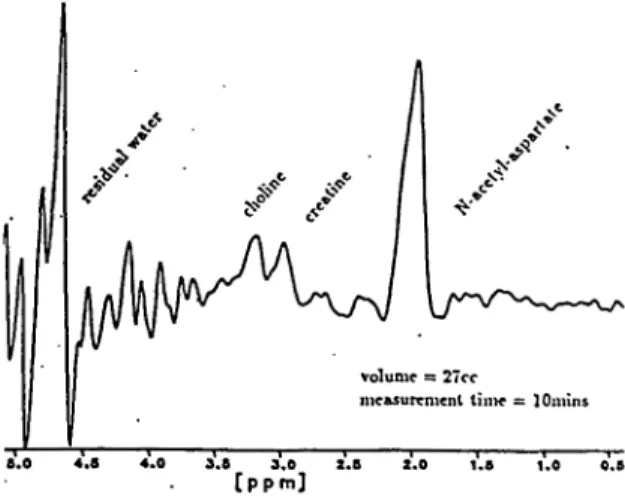 Figure 2. Localised Proton Spectrum from a Normal Brain An example of an in vivo localised proton spectrum is shown in fig