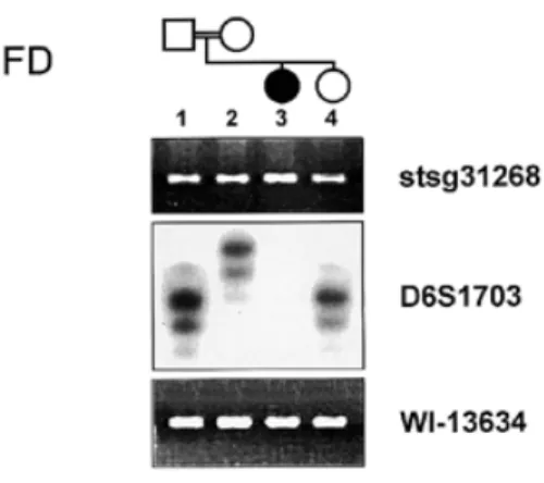 Figure 1. Homozygous deletion within the EPM2 critical region. Relevant portions of gels showing the typing of the non-polymorphic STS markers stsg31268 and WI-13634 (ethidium bromide-stained agarose gels) and the microsatellite marker D6S1703 (polyacrylam