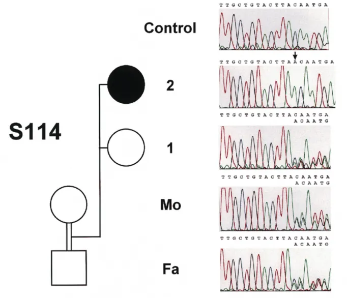 Figure 5. Segregation of the EPM2 Y31fs  loss-of-function mutation in family S114. The affected individual is identified in the pedigree by a solid symbol