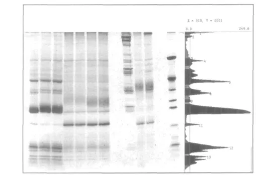 Fig. 3. Original gel together with the profile of lane 1. The peaks are indicated in black, and are numbered sequentially from top to bottom.