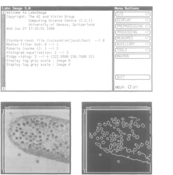 Fig. 7. A session example with Labolmage. The master window displays all operations executed to extract edges from the bacterial cell image (original image from E.Kellenberger, in Molecular Biology of the Cell by B.Alberts, D Bray, J.Lewis, M.Raft, K.Rober