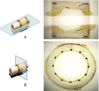 Fig. 6. Histology analysis of the connector explanted 12 months after the procedure (A, axial section; B, coronal section)