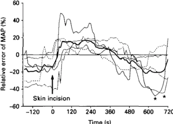 Figure 3 Relative error of mean blood pressure (MAP) vs time during skin incision period (3 min before, 12 min after) using human control