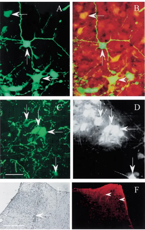Figure 1. EGFP expression, NeuN immunostaining and FG-retrograde labeling in spinal motoneurons