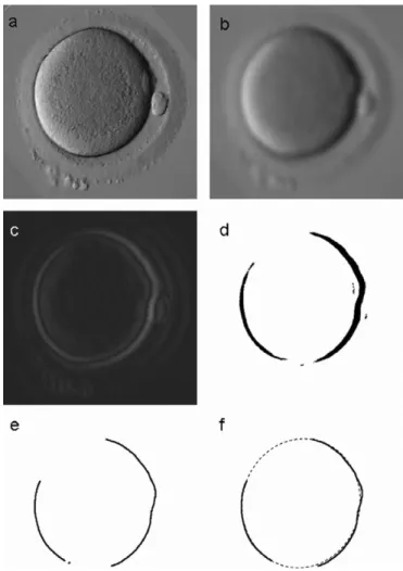 Figure 3: Detection of an ellipse (foreground) where the studied oolemma lies.