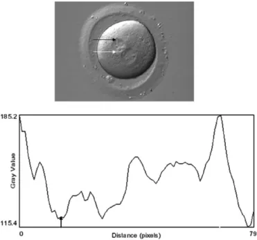 Figure 5: Profile of the grey values along a line in one pronucleus.