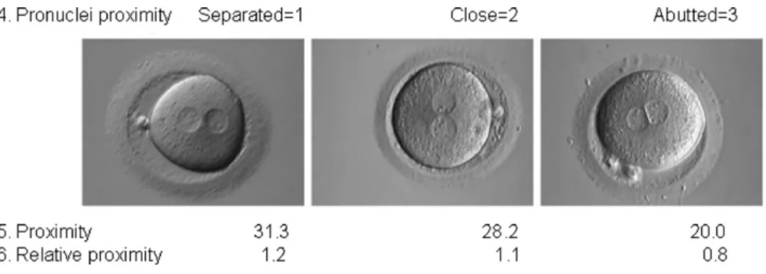 Figure 10: (7) Orientation of the PN according to the polar bodies.