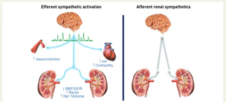 Figure 1 Efferent and afferent renal sympathetic nerves (modified with permission from Lu¨scher, PCR-EAPCI Textbook)