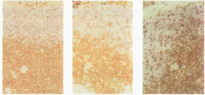 Fig. 4. Immunohistochemical staining shows binding of HP2/9 mAb to clusters of cortical thymocytes, most medullary thymocytes and thymtc stromal components